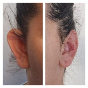 WhatsApp Image 2024-07-27 at 8.07.16 PM