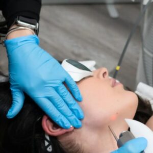 Fotona 4D Lift _ Laser Skin Tightening _ Skintellect