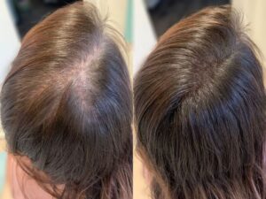 Hair Fiber for Thinning Hair