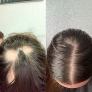 Hair Growth Vitamins & Cosmetics