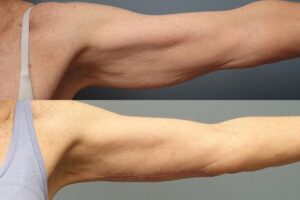 ✨✨✨Another amazing result